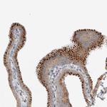 SLC38A10 Antibody in Immunohistochemistry (IHC)