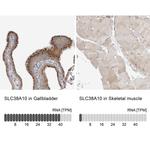 SLC38A10 Antibody