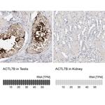 Actin-like 7B Antibody in Immunohistochemistry (IHC)