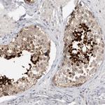 Actin-like 7B Antibody in Immunohistochemistry (IHC)