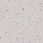 Actin-like 7B Antibody in Immunohistochemistry (IHC)