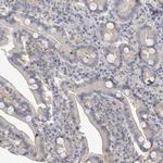 Actin-like 7B Antibody in Immunohistochemistry (IHC)