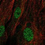 KIAA1456 Antibody in Immunocytochemistry (ICC/IF)