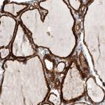 KIAA1456 Antibody in Immunohistochemistry (IHC)