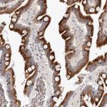 KIAA1456 Antibody in Immunohistochemistry (IHC)