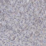 KIAA1456 Antibody in Immunohistochemistry (IHC)