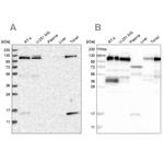 RABEP1 Antibody in Western Blot (WB)