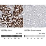 ACSF2 Antibody