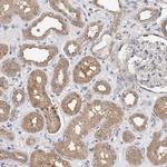 FHOD3 Antibody in Immunohistochemistry (IHC)