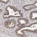 FHOD3 Antibody in Immunohistochemistry (IHC)