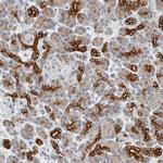 SLC28A3 Antibody in Immunohistochemistry (IHC)