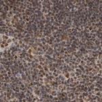 ZNF830 Antibody in Immunohistochemistry (IHC)