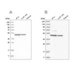 ZNF830 Antibody in Western Blot (WB)