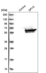 DPYS Antibody in Western Blot (WB)