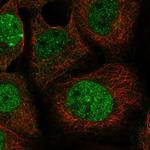 LETM2 Antibody in Immunocytochemistry (ICC/IF)