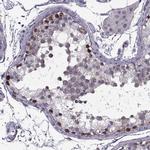 LETM2 Antibody in Immunohistochemistry (IHC)