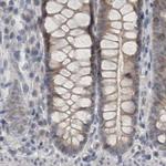 ACTRT2 Antibody in Immunohistochemistry (IHC)