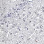 ACTRT2 Antibody in Immunohistochemistry (IHC)