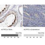 ACTRT2 Antibody