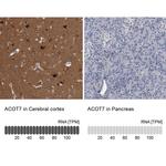 ACOT7 Antibody in Immunohistochemistry (IHC)