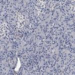 ACOT7 Antibody in Immunohistochemistry (IHC)