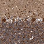 ACOT7 Antibody in Immunohistochemistry (IHC)