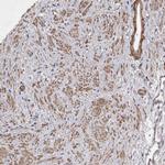 EDEM3 Antibody in Immunohistochemistry (IHC)