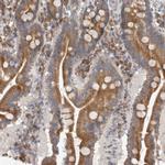 EDEM3 Antibody in Immunohistochemistry (IHC)