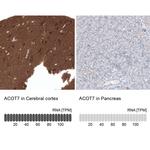 ACOT7 Antibody