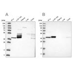 ACOT7 Antibody in Western Blot (WB)