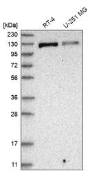 RECQ4 Antibody in Western Blot (WB)