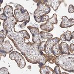 RAB11FIP1 Antibody in Immunohistochemistry (IHC)