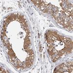 RAB11FIP1 Antibody in Immunohistochemistry (IHC)