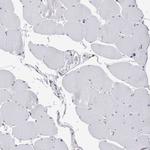 RAB11FIP1 Antibody in Immunohistochemistry (IHC)