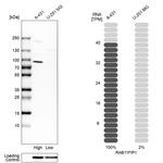 RAB11FIP1 Antibody in Western Blot (WB)