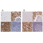 ALDH8A1 Antibody in Immunohistochemistry (IHC)