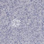 ALDH8A1 Antibody in Immunohistochemistry (IHC)