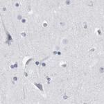 ALDH8A1 Antibody in Immunohistochemistry (IHC)