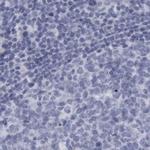 ALDH8A1 Antibody in Immunohistochemistry (IHC)