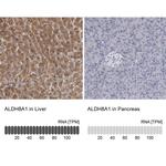 ALDH8A1 Antibody