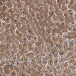 ALDH8A1 Antibody in Immunohistochemistry (IHC)