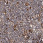 CAMSAP2 Antibody in Immunohistochemistry (IHC)