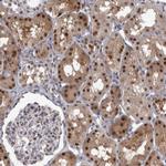 PSMB2 Antibody in Immunohistochemistry (IHC)