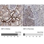 DBT Antibody in Immunohistochemistry (IHC)