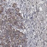 DBT Antibody in Immunohistochemistry (IHC)