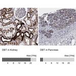 DBT Antibody in Immunohistochemistry (IHC)