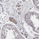 DBT Antibody in Immunohistochemistry (IHC)