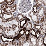 DBT Antibody in Immunohistochemistry (IHC)