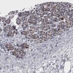 DBT Antibody in Immunohistochemistry (IHC)