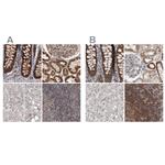 AspRS Antibody in Immunohistochemistry (IHC)